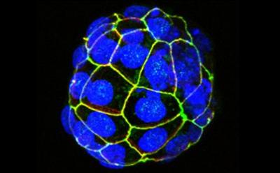 Blastocyst
